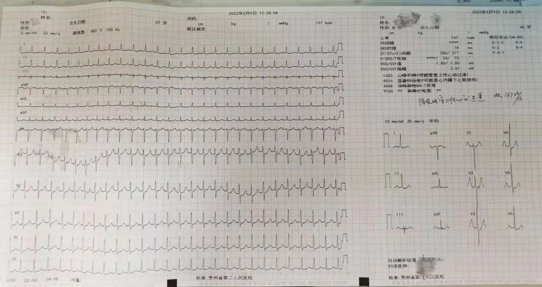 澳门一肖一码一待一中，准确资料解释与落实